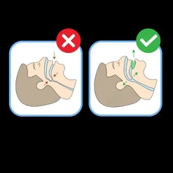 🔮 Descubre el Antironquidos Silent Pro: Tu solución definitiva para noches tranquilas