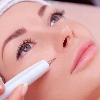 ✨ Cauterizador de Plasma Recargable - 💆‍♀️ Elimina Imperfecciones Sin Dolor - 🚚 Pago Contraentrega